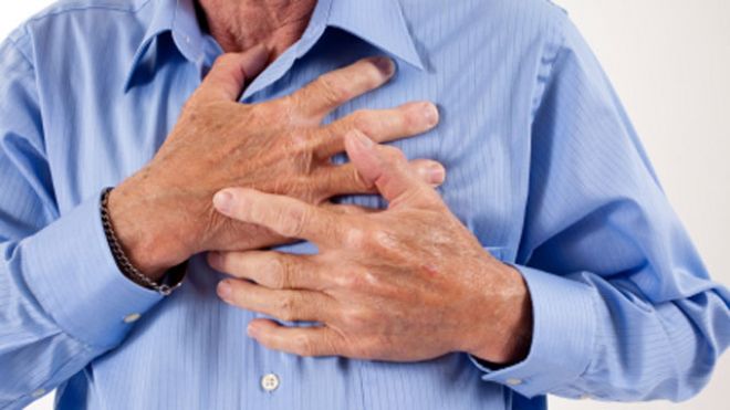 First Aid: What to do when someone is having a heart attack