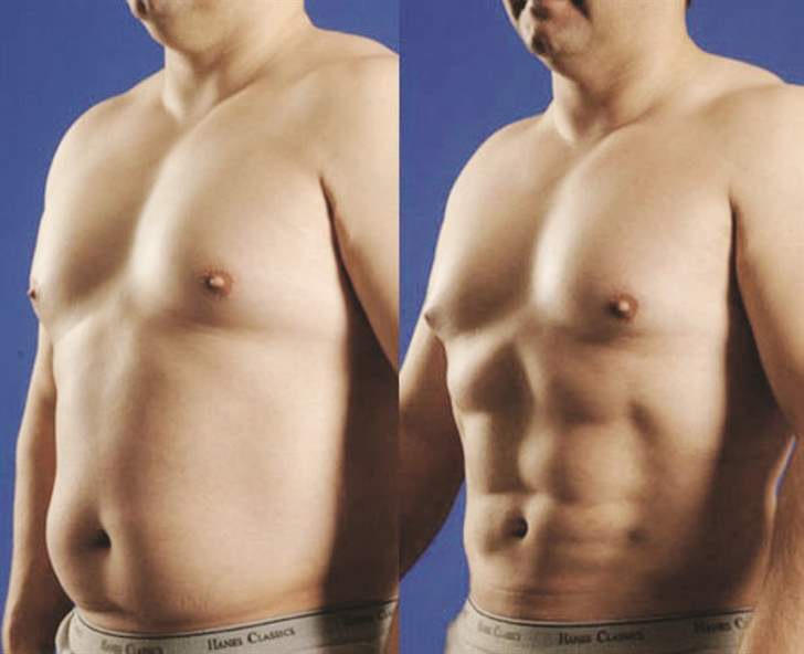 Kuwait GCC nationals travelling to Lebanon for plastic surgery on the rise