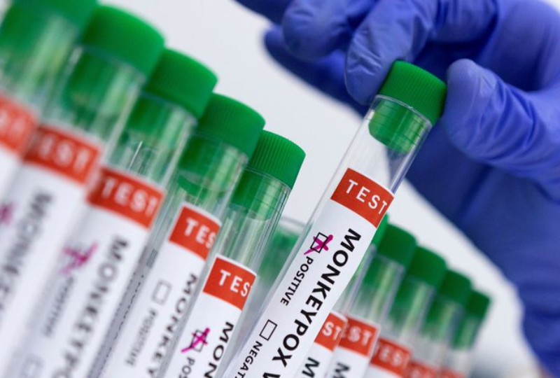 World News: Mainland China reports first imported monkeypox case