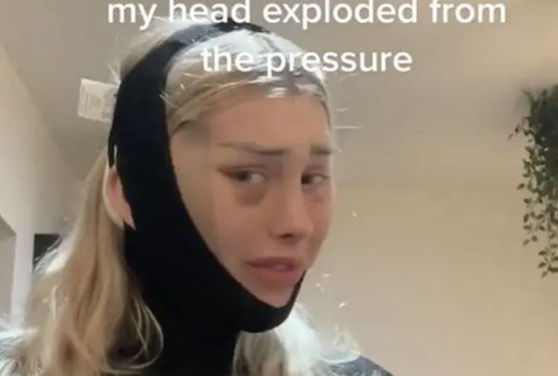 OMG: Back of woman's head 'explodes' due to air pressure on flight