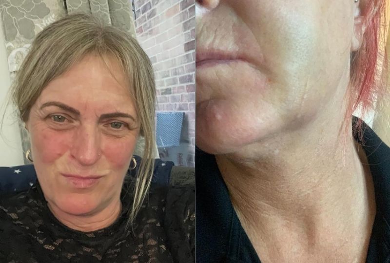 OMG: Mum receives £10,000 settlement after dentist broke her jaw during ...