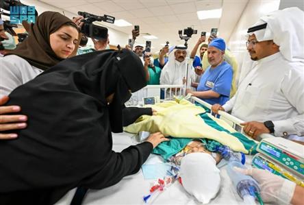 Conjoined twins successfully separated in Riyadh,...