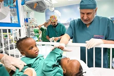 Separation surgery of Tanzanian conjoined twins...