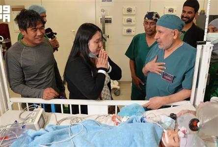 Saudi medical team successfully separates Filipino...
