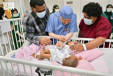 Fijian conjoined twins successfully separated...